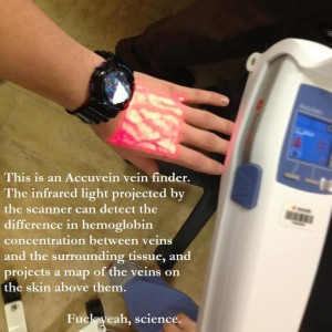 This is an Accuvein vein finder. The infrared light projected by the scanner can detect the difference in hemoglobin concentration between veins and the surrounding tissue, and projects a map of the veins on the skin above them.