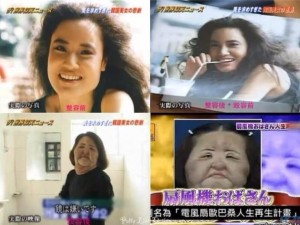 The worst before and after beauty surgery long term side effect